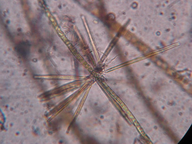 asterionella (10x40)