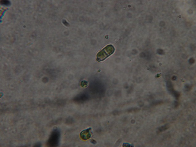 Pleurococcus viridis (10x40)
