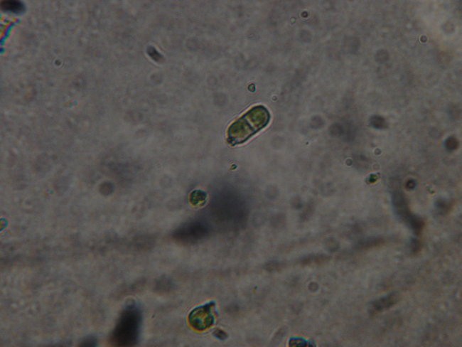 pleurococcus viridis (10x40)