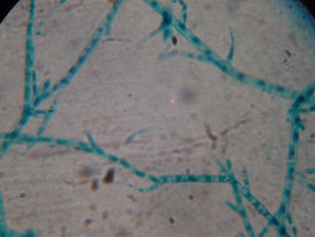 Stigeoclonium (10x40)