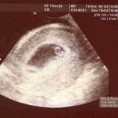 6 tednov, 14.2.2008