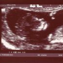 12 tednov, 3 dni, NS, 28.3.2008