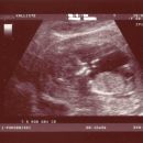 12 tednov, 3 dni, NS, 28.3.2008